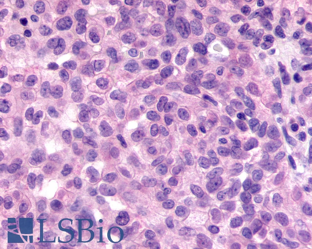 IHC-plus™ Polyclonal Rabbit anti-Human ADGRV1 / GPR98 Antibody (N-Terminus, IHC, WB)