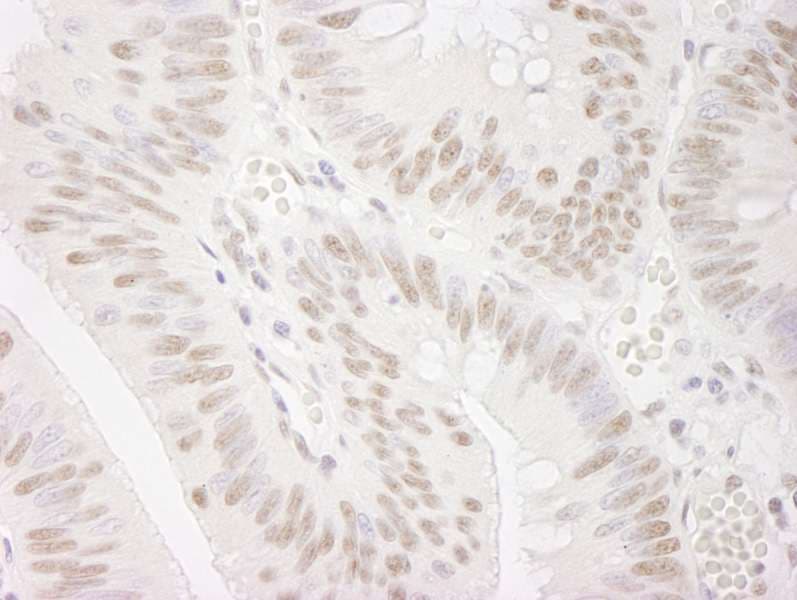 Polyclonal Rabbit anti-Human SMEK1 Antibody (aa770-C-term, IHC, IF)