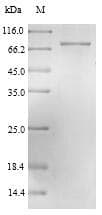 Lassa Virus SARS-CoV Nucleoprotein (Recombinant 6His-SUMO, N-terminus)