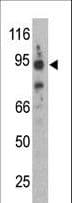 SNCAIP / Synphilin 1 Antibody (aa593-622)