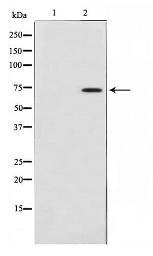 COL13A1 / Collagen XIII Antibody