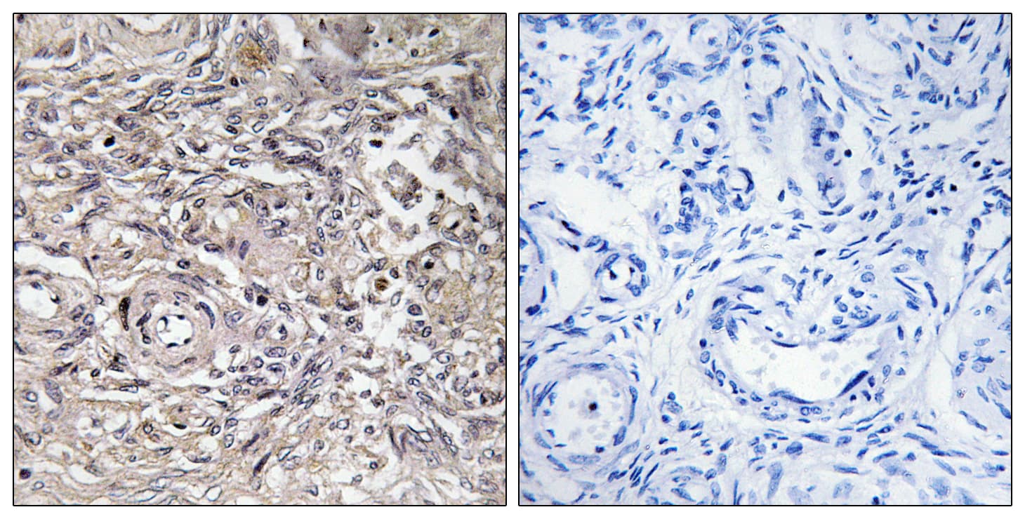 CLDN6 / Claudin 6 Antibody (aa81-130)