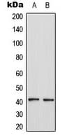 CCR4 Antibody (Internal)