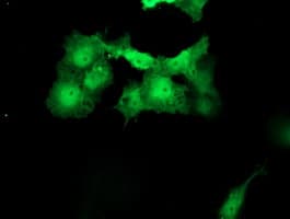 MEIS3 Antibody (aa1-261, clone OTI2E12, Carrier-free)