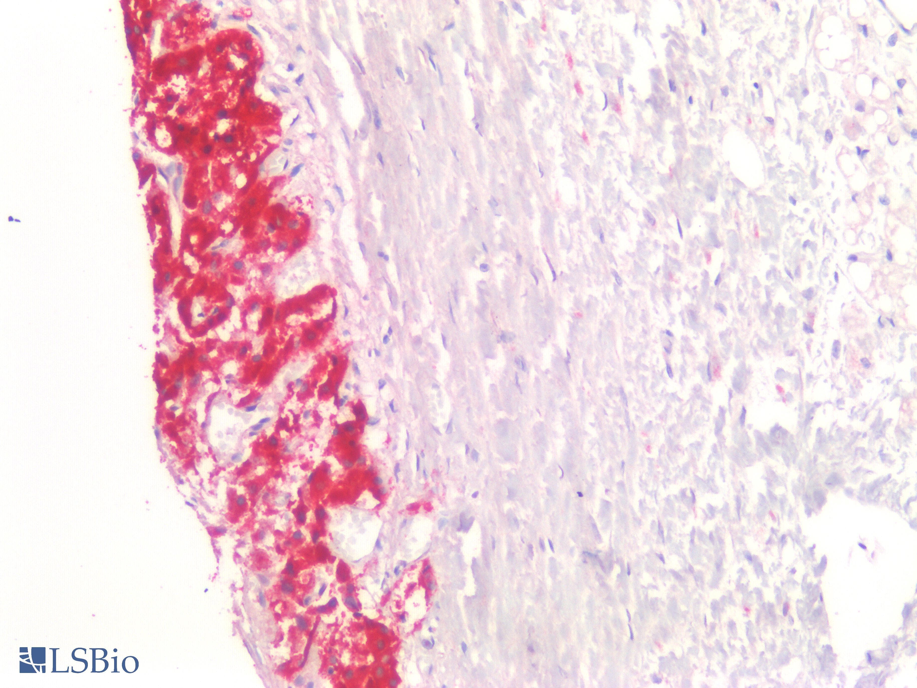PathPlus™ Polyclonal Rabbit anti-Human CHGA / Chromogranin A Antibody (IHC)