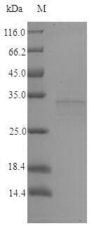 Brucella abortus vjbR Protein (Recombinant 6His, N-terminus)