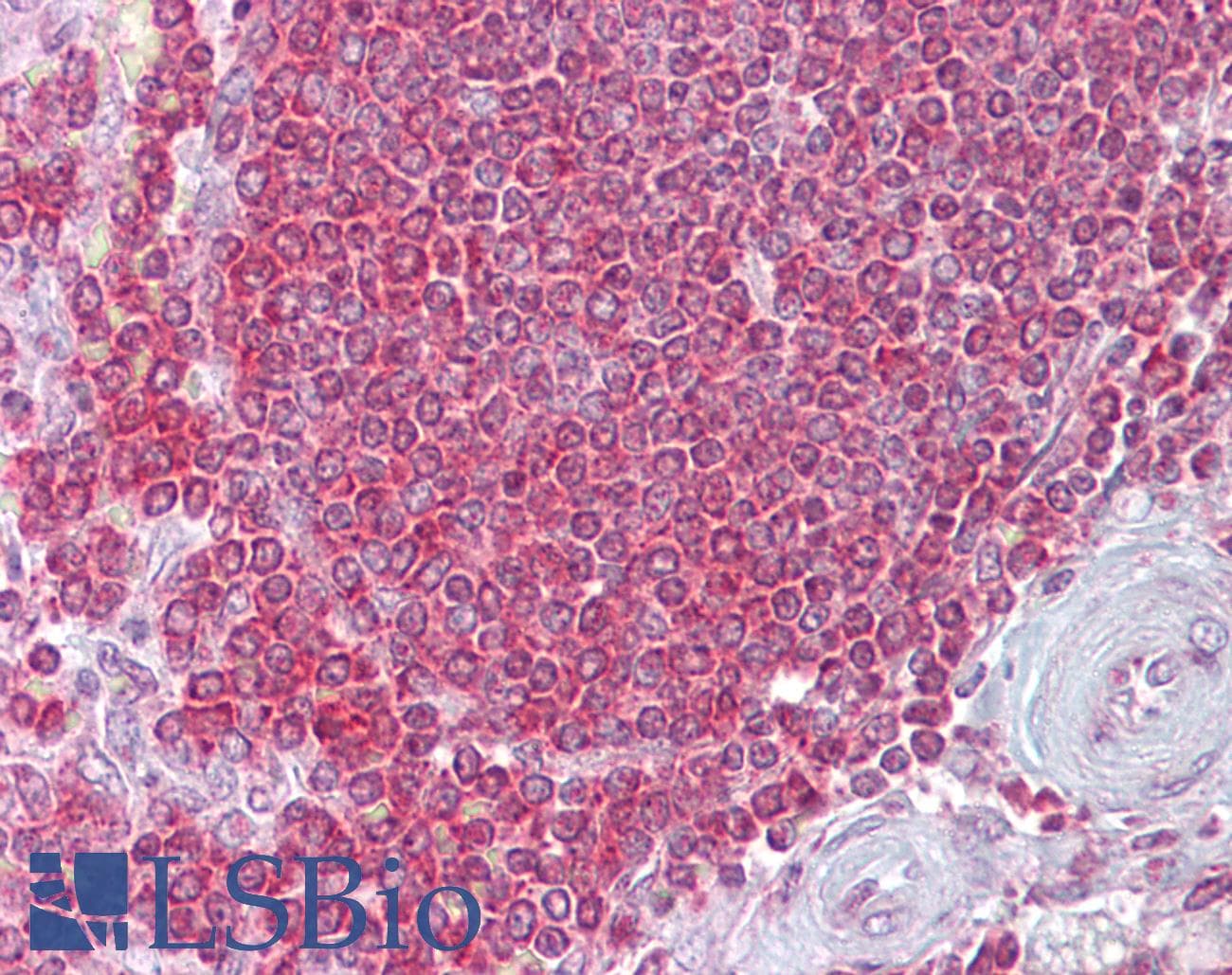 RPSA / Laminin Receptor Antibody (aa107-156)
