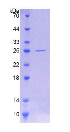 Human POMT1 Protein (Recombinant His-T7)