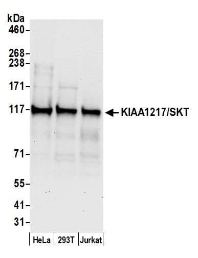 KIAA1217 Antibody (aa1625-1675)