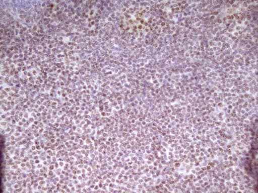 Monoclonal Mouse anti-Human SP110 Antibody (clone OTI4C1, aa232-521, IHC, WB)