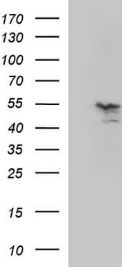 MMP13 Antibody (aa104-471, clone OTI1F1)