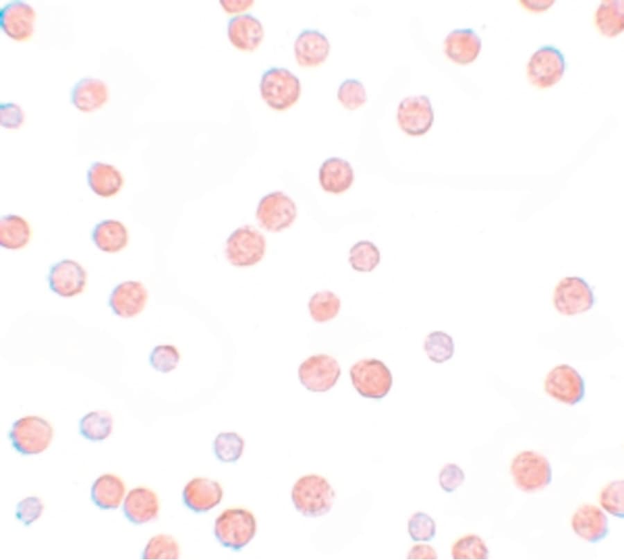 IHC-plus™ PAPPA2 / Pappalysin 2 Antibody