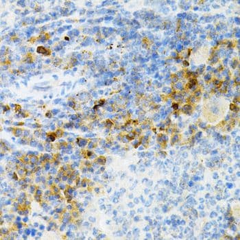 Polyclonal Rabbit anti-Human SULT2A1 / Sulfotransferase 2A1 Antibody (IHC, WB)