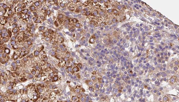 Polyclonal Rabbit anti-Human KV6.4 / KCNG4 Antibody (IHC, WB)