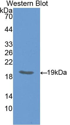 IHH Antibody (aa240-399)