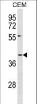 ACKR1 / DARC Antibody (aa1-30)