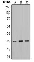 MPZ / P0 Antibody (Internal)