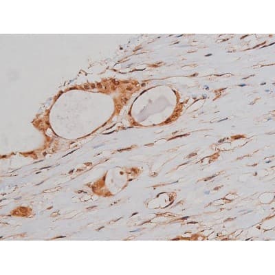 MAPT / Tau Antibody (phospho-Ser262)