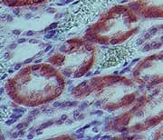 IL-1B / IL-1 Beta Antibody (clone 43N3D8)