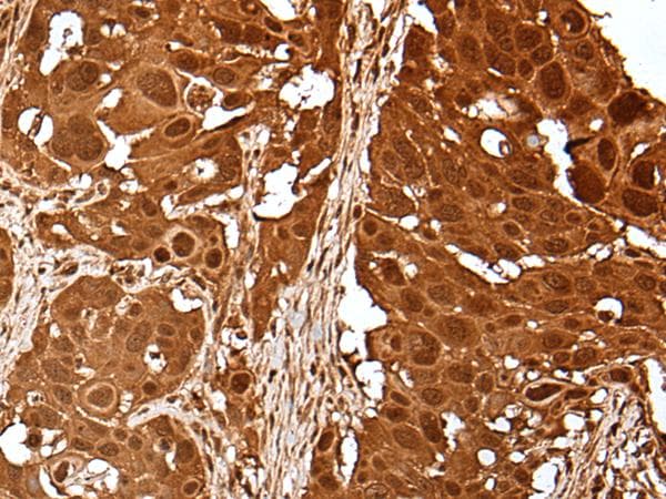 UEV1 / UEV1A Antibody