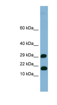 HSPC176 / TRAPPC2L Antibody (N-Terminus)