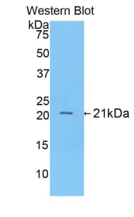 FGA / Fibrinogen Alpha Antibody (aa77-244)