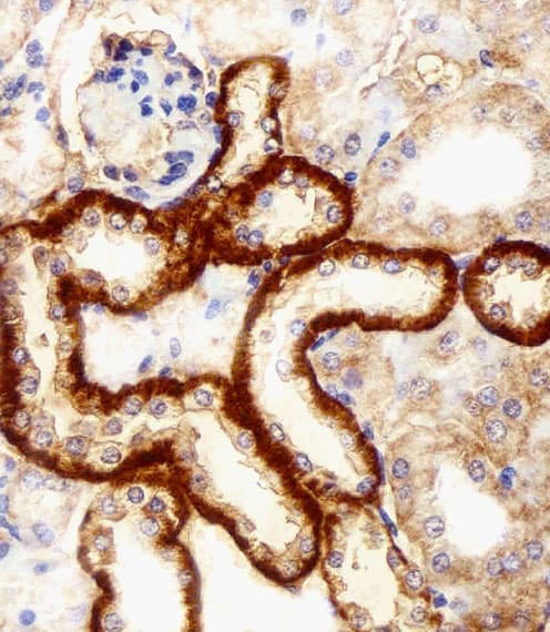 FBXL17 Antibody (aa262-297)