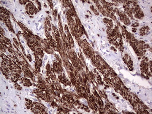 NR1I3 / CAR Antibody (aa1-236, clone OTI1C6)