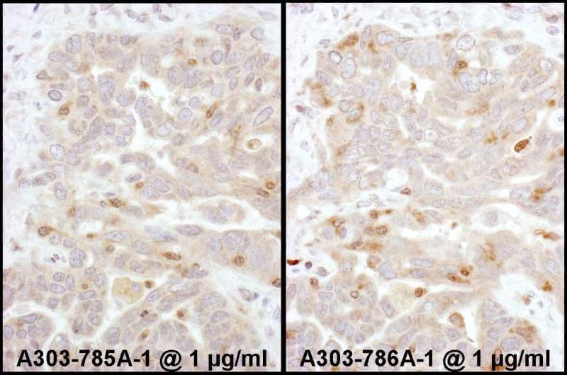 ARRB2 / Beta Arrestin 2 Antibody (aa310-360)