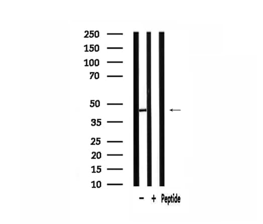 AGPAT5 Antibody