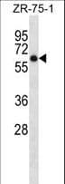 ARSD / Arylsulfatase D Antibody (aa502-532)
