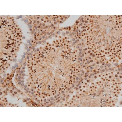 CREB1 / CREB Antibody (phospho-Ser133)