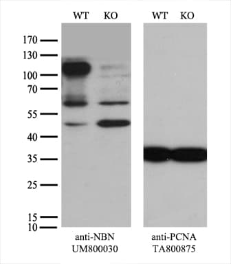 Monoclonal Mouse anti-Human NBN / Nibrin Antibody (clone UMAB100, aa183-460, IHC, IF, WB)