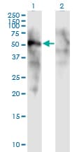 FOXD1 Antibody (clone 2C10)