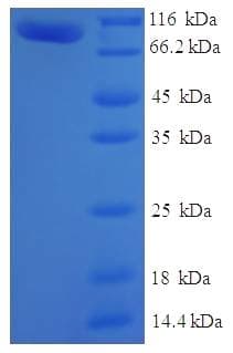 Human MTMR7 Protein (Recombinant His-SUMO)