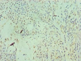 Polyclonal Rabbit anti-Human RAN Antibody (aa1-216, IHC, WB)