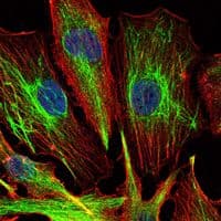 KLHL22 Antibody (clone 7B10)