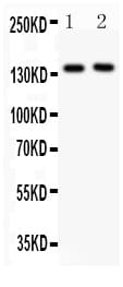 SELP / P-Selectin / CD62P Antibody (aa42-271)