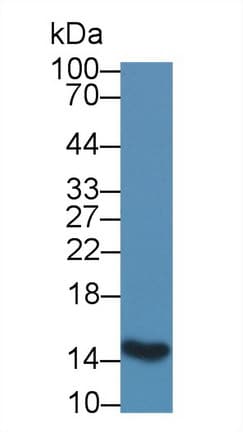 I-FABP / FABP2 Antibody (aa4-129)
