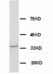 WDR83 Antibody (N-Terminus)