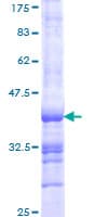Human PKP1 / Plakophilin 1 Protein (Recombinant GST, N-terminus)