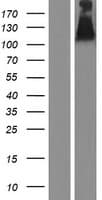 UNC5H2 / UNC5B Protein (Over-Expression Lysate Myc-DDK (Flag))