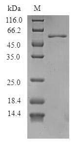 Peanut Allergen Ara h 1 Protein (Recombinant 6His, N-terminus)