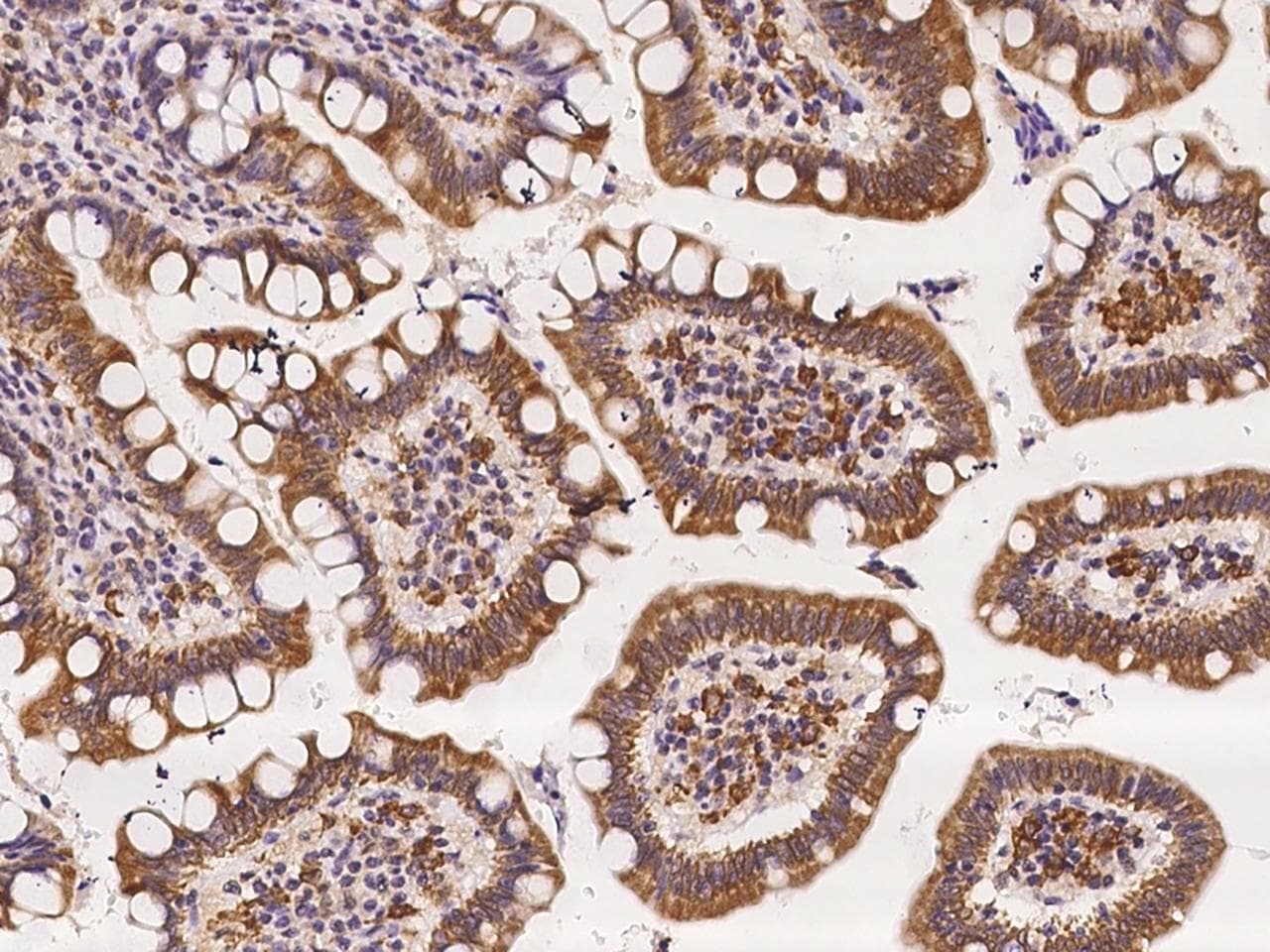 RGS6 Antibody
