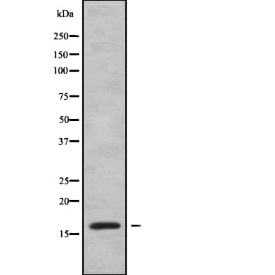 Polyclonal Rabbit anti-Human VPREB1 / CD179A Antibody (WB)