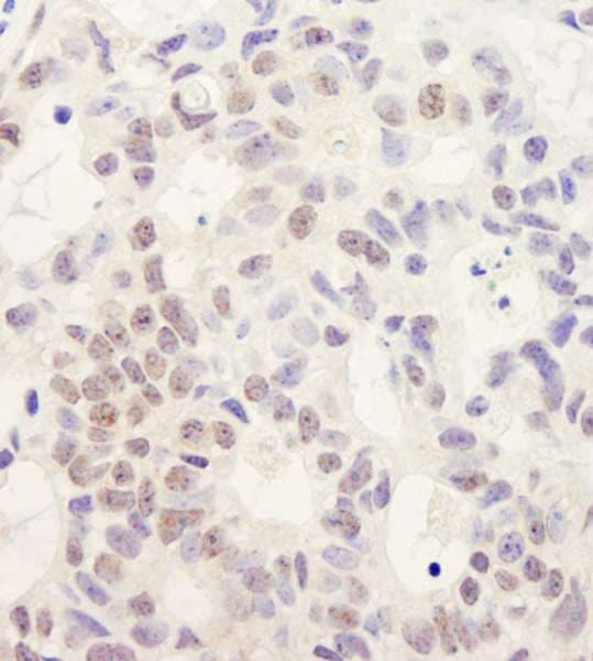 DHX38 Antibody (aa1200-C-term)