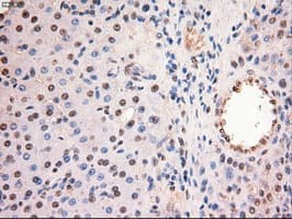 MYC / c-Myc Antibody (clone OTI5G3)