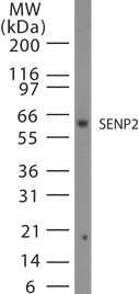 Polyclonal Rabbit anti-Human SENP2 Antibody (WB)