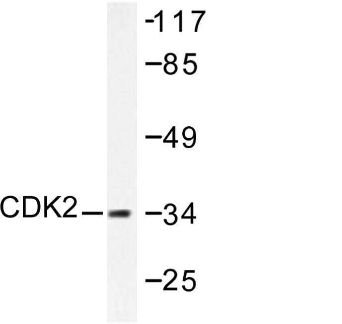 CDK2 Antibody (Val154)