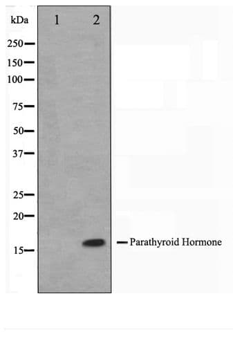 Polyclonal Rabbit anti-Human PTH / Parathyroid Hormone Antibody (WB)